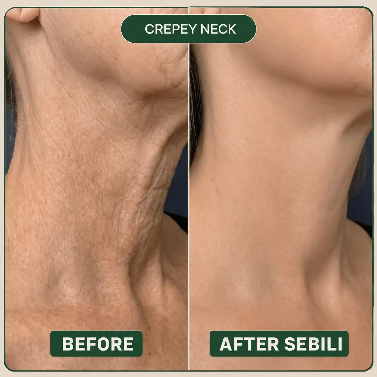 Sebili Bio-Collagen Neck Patch