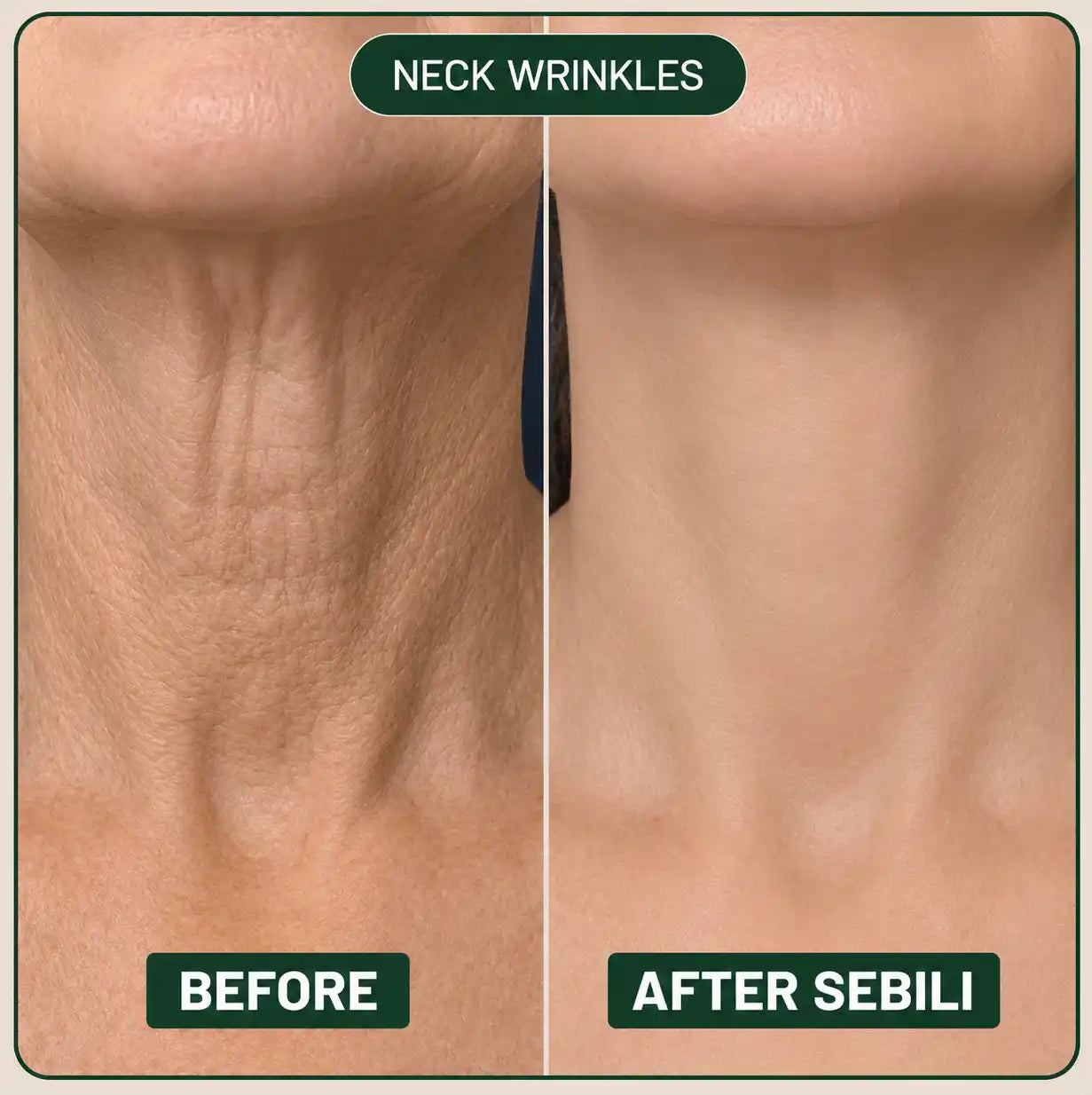 Sebili Bio-Collagen Neck Patch